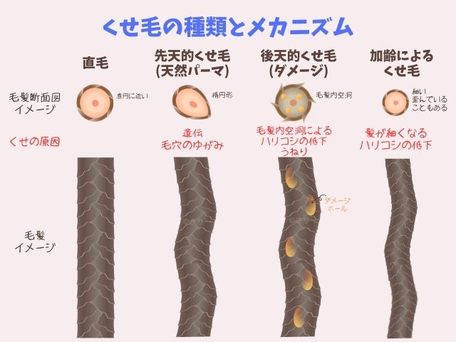 くせ毛の種類とメカニズム